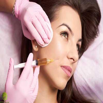 تزریق ژل خط غم در اصفهان 09190231250 - دکتر مهسا یزدخواستی