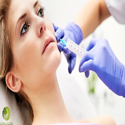 تزریق ژل خط خنده در اصفهان | 09190231250💫